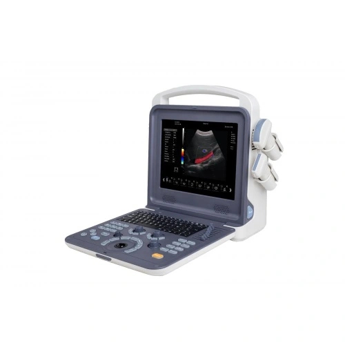 4D Portable Handheld Color Doppler Ultrasound Scanner