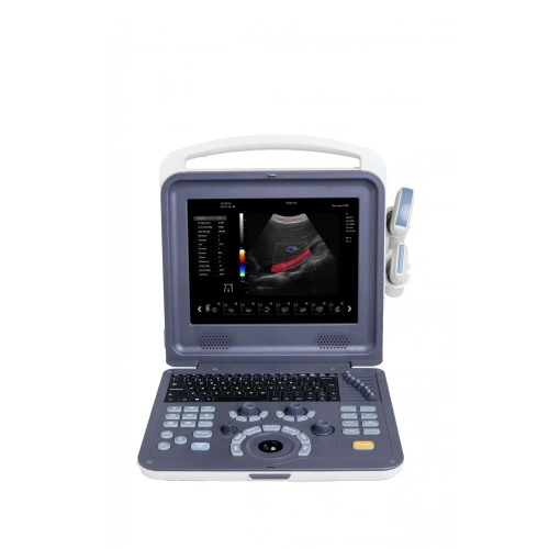 Portable 4D Cardiac Color Doppler Ultrasound Scanner