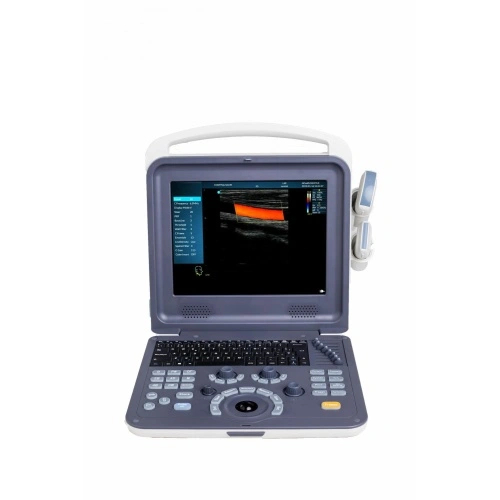 Multi-Function medical tablet portable ultrasound machine