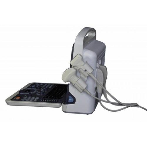 Portable 4D Cardiac Color Doppler Ultrasound Scanner